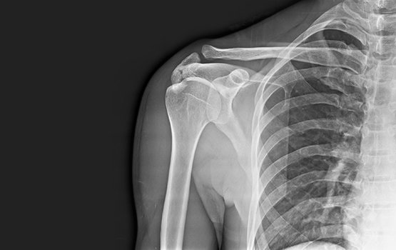 xray1-sharad-orthopedic-hospital-pune